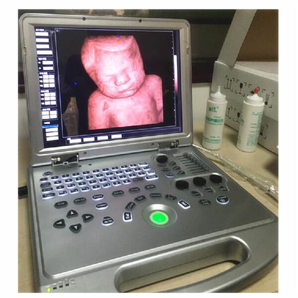 Pencitraan Waktu Nyata, Kapan Saja, Di Mana Saja dengan Perangkat Ultrasound Seluler.