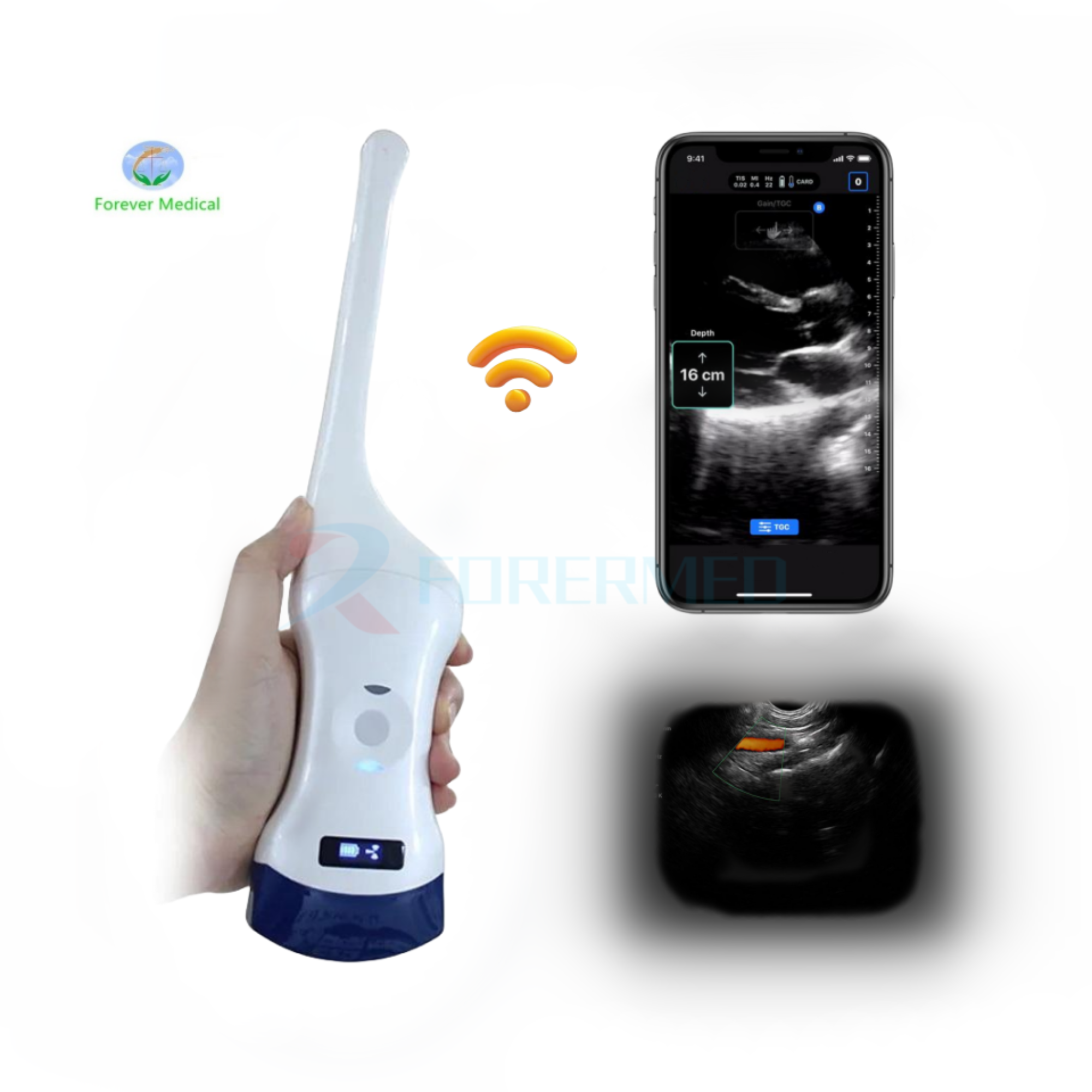 Transvaginal Ultrasound YJ-CT5