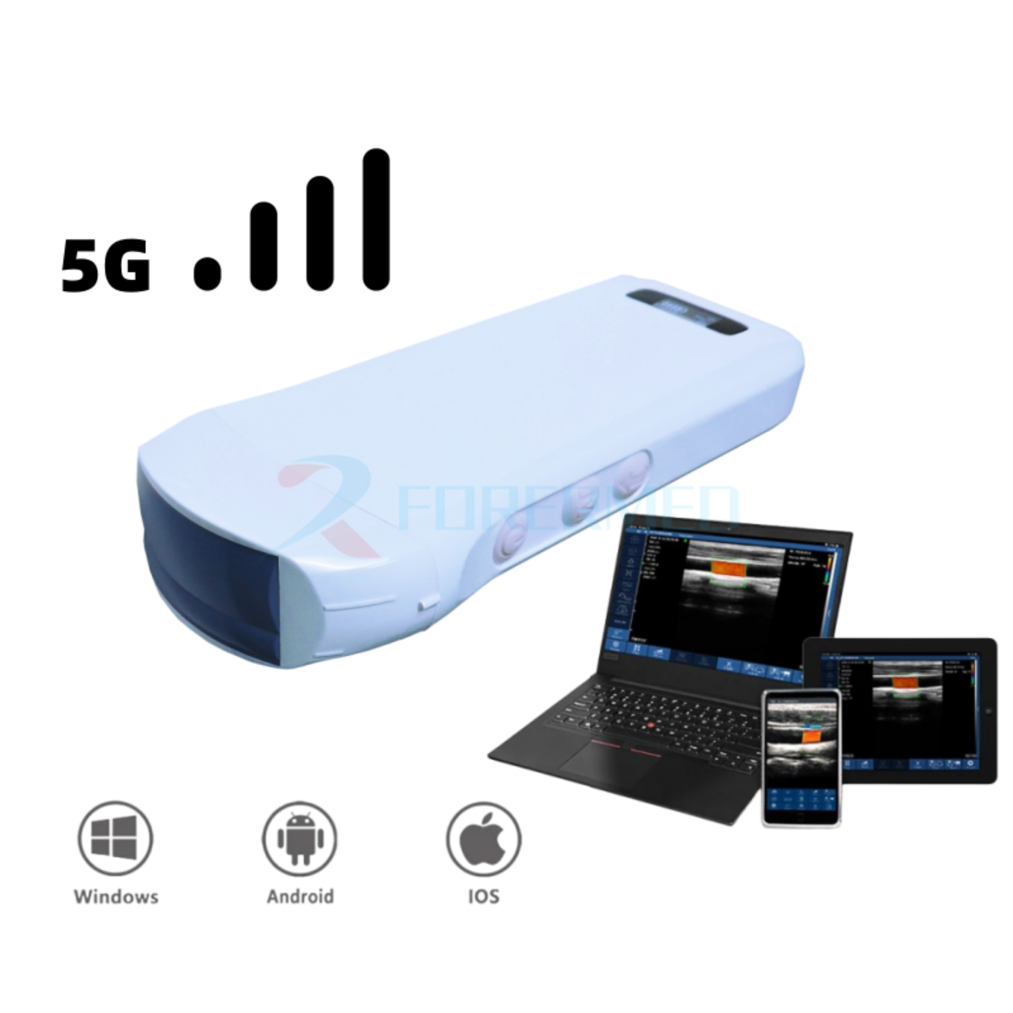 Handheld Wireless Ultrasound YJ-C10T