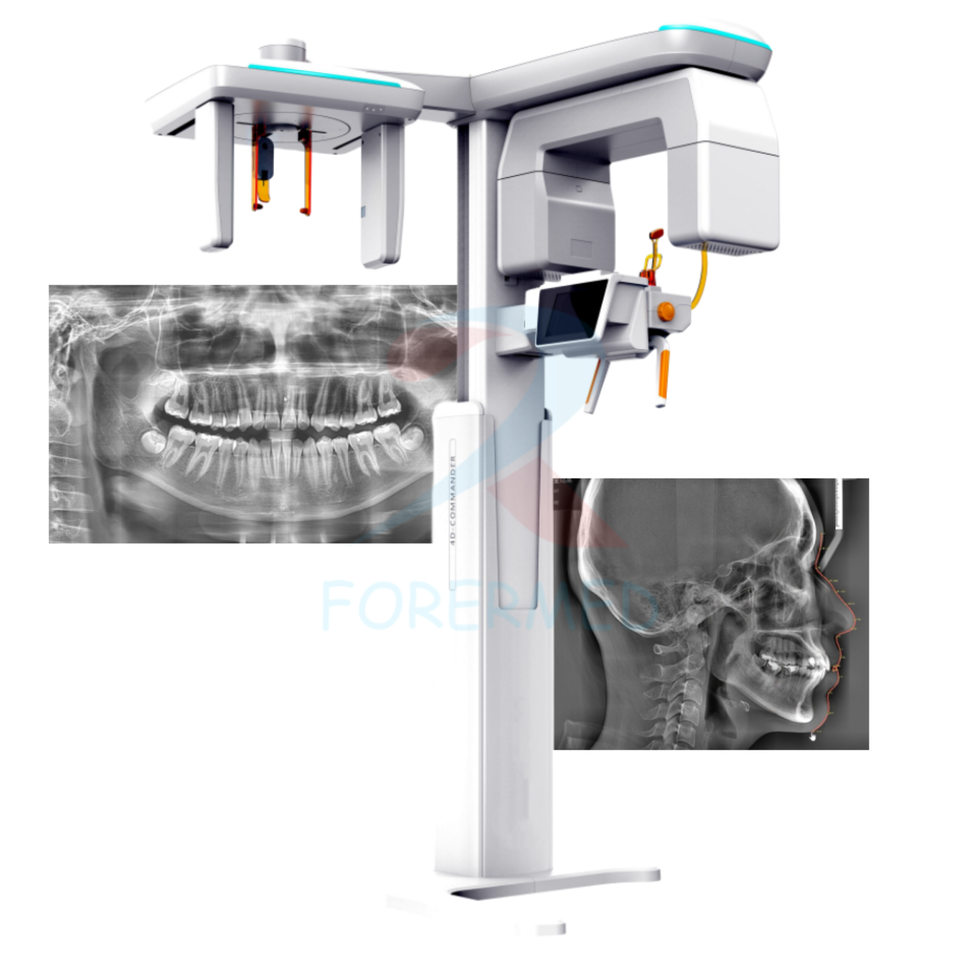 3D Panoramic Dental X-Ray