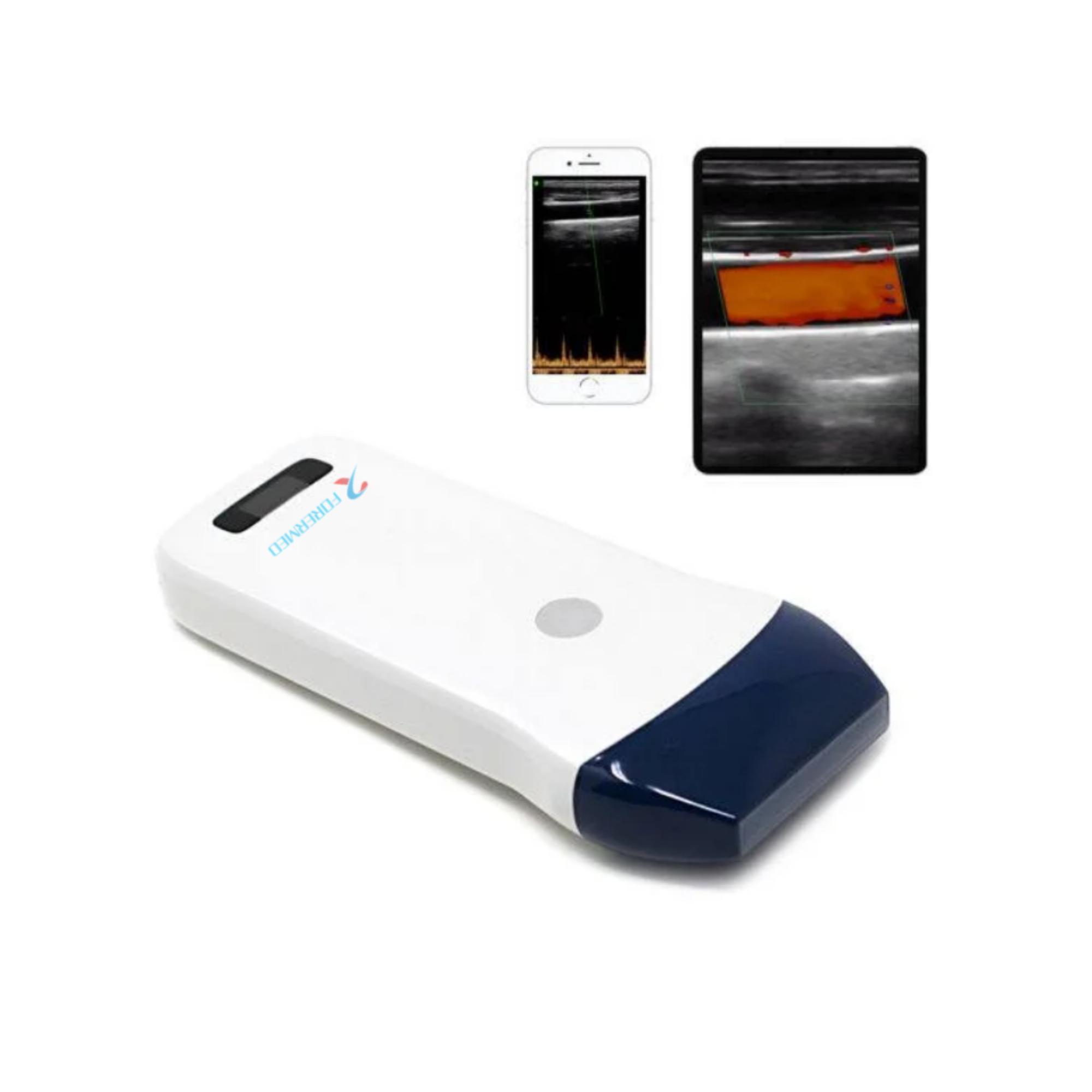 Wireless Handheld Ultrasound YJ-CP5L