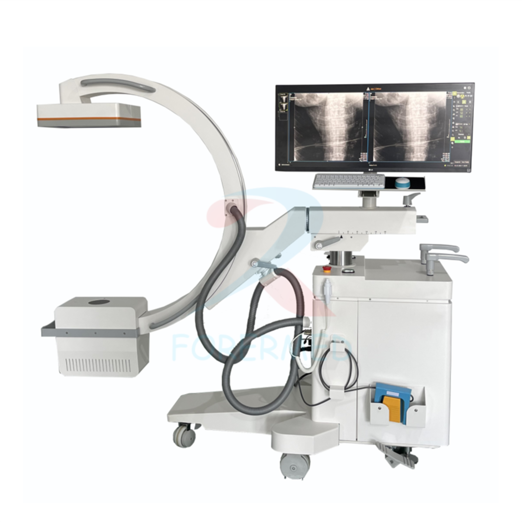 Digital C-arm X-ray Machine