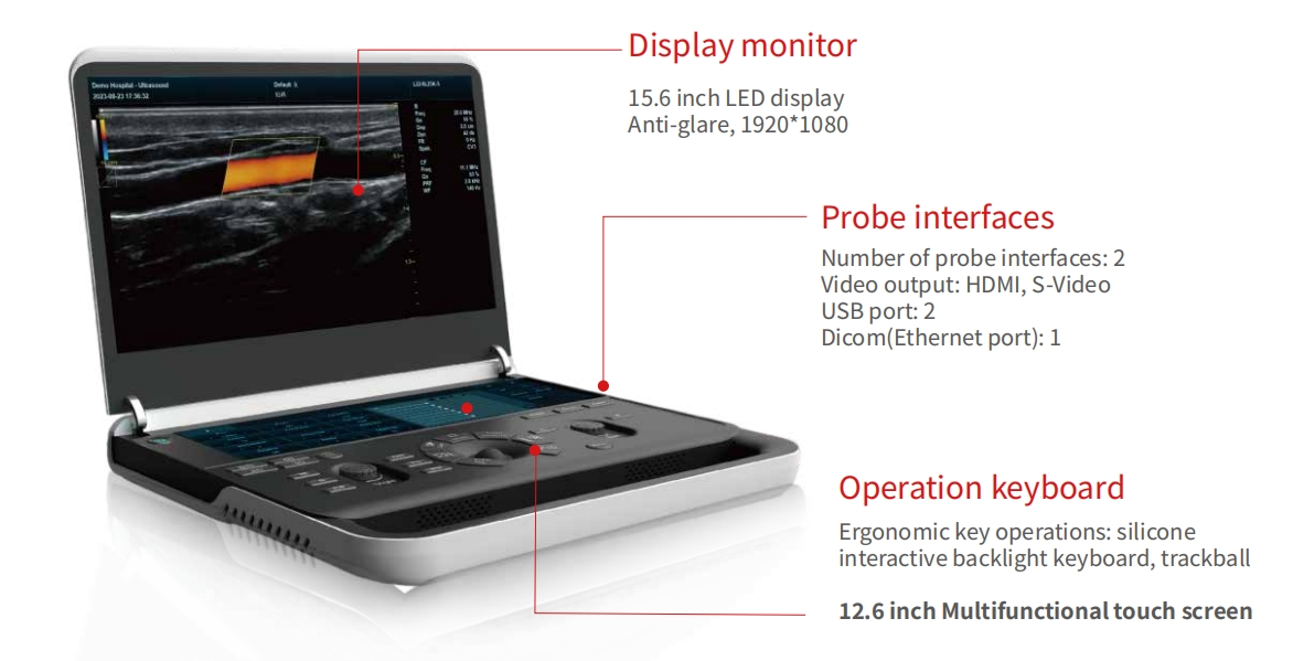 Digital ultrasound machine