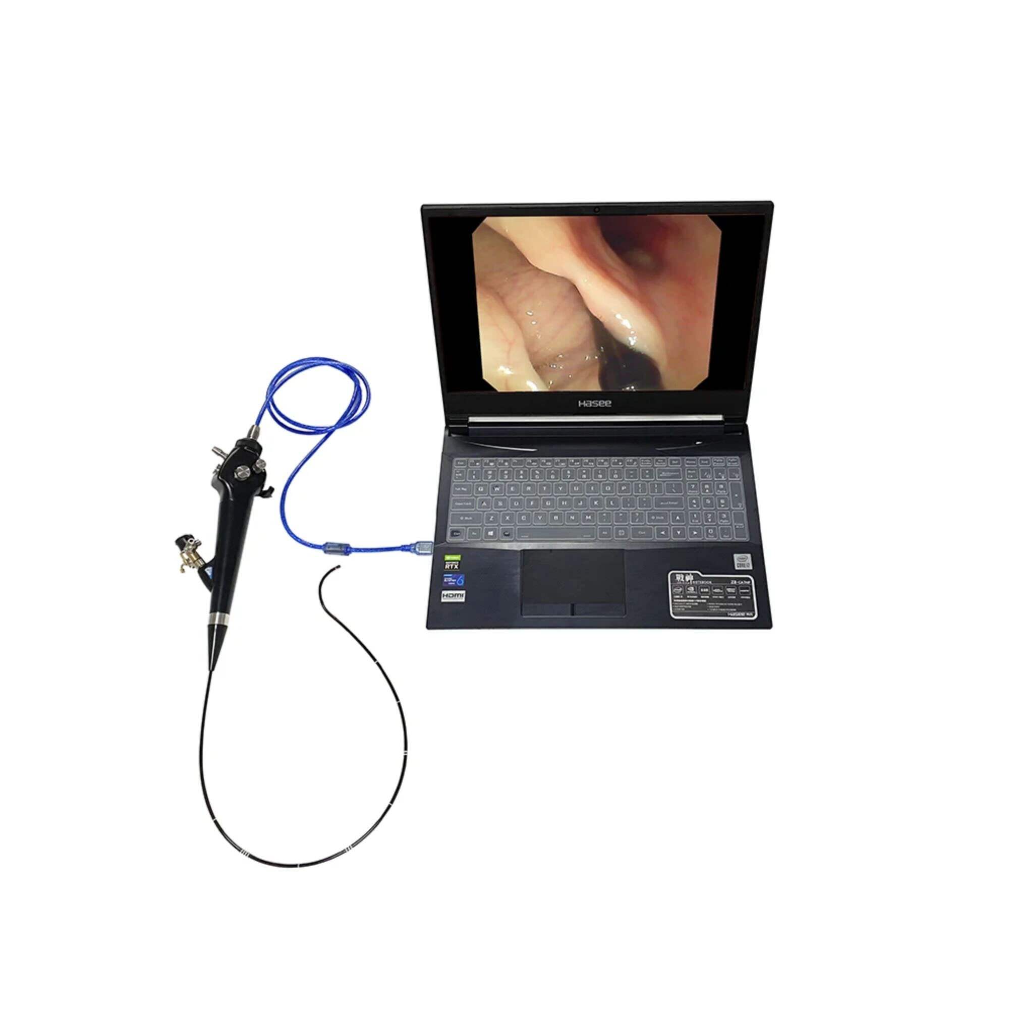 Portable USB Video Ureteroscope