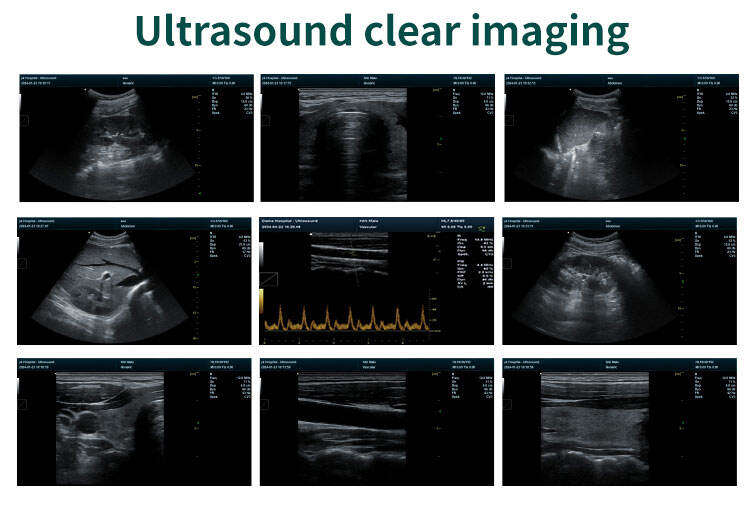 portable ultrasound