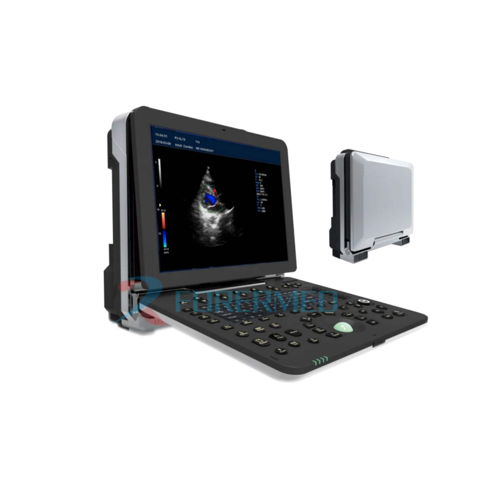 Portable Cardiac Ultrasound YJ-P8