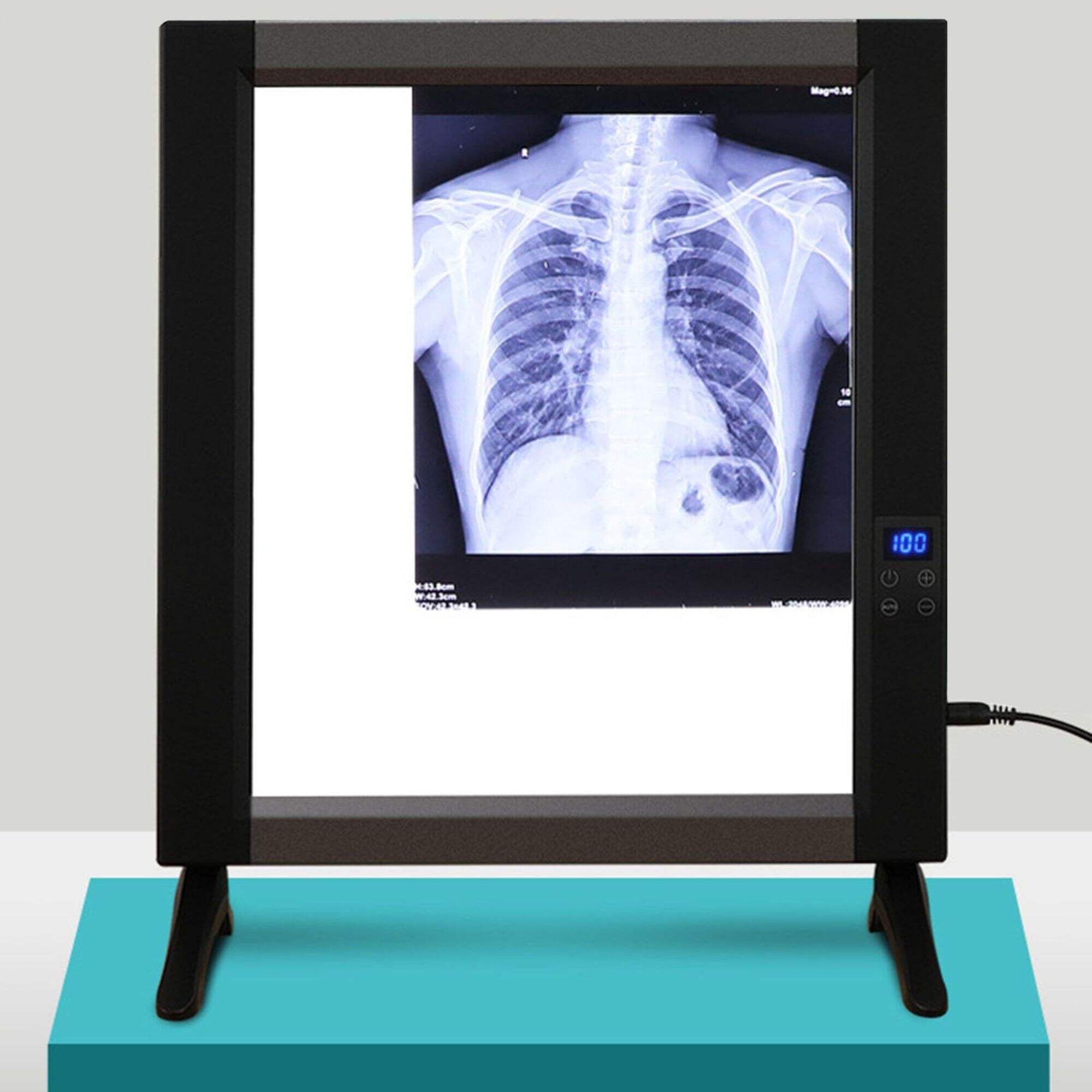 X-ray Viewer Film Illuminator 