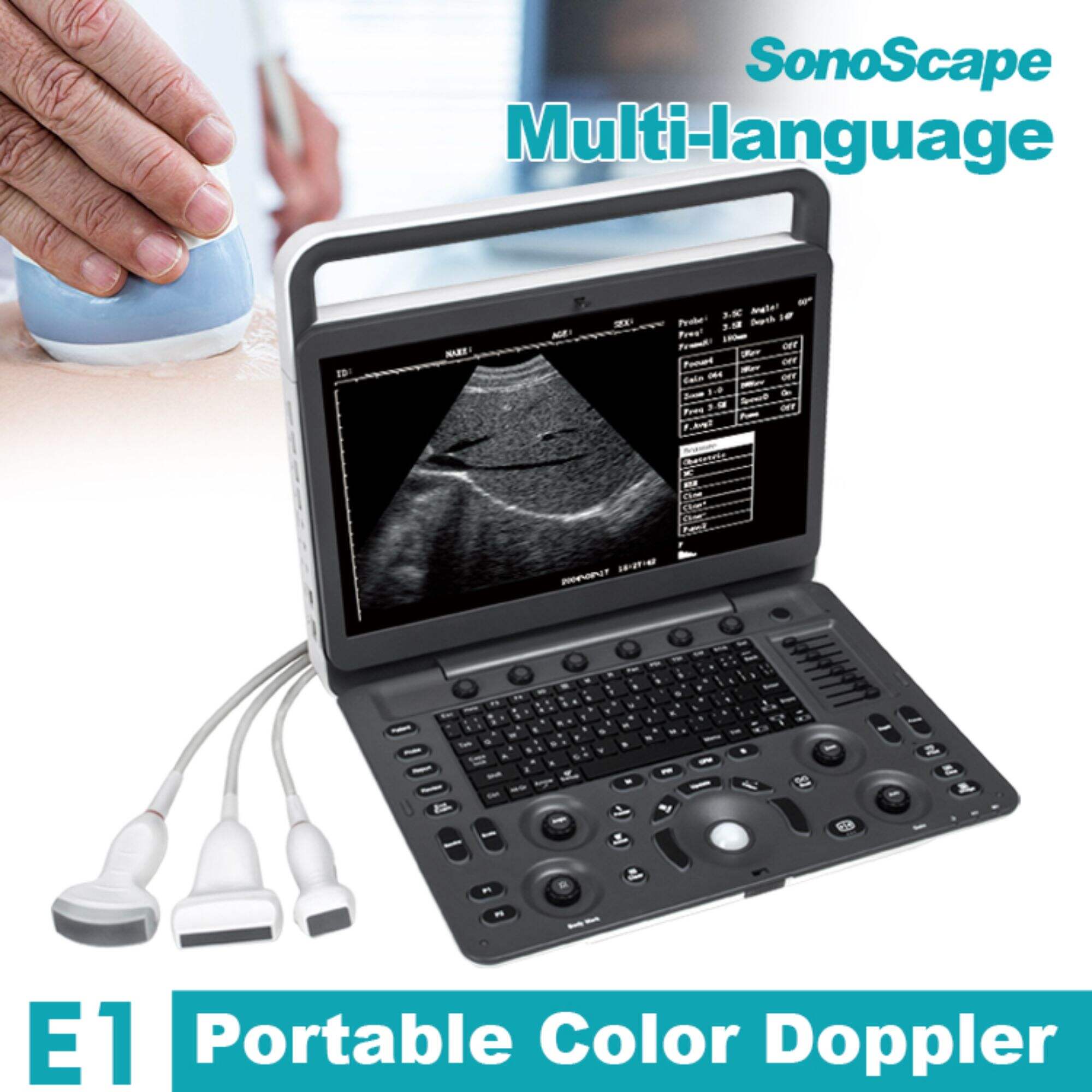 Sonoscape E1 Ultrasound Machine