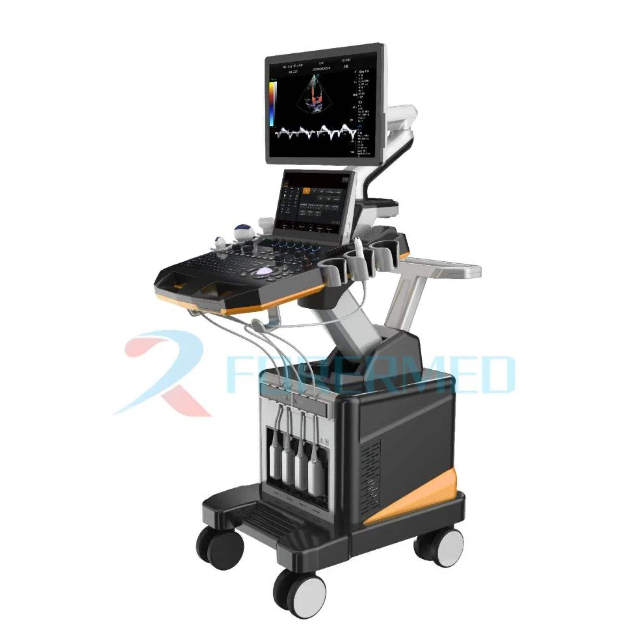 Non-Invasive Diagnosis with the Cardiac Ultrasound Machine