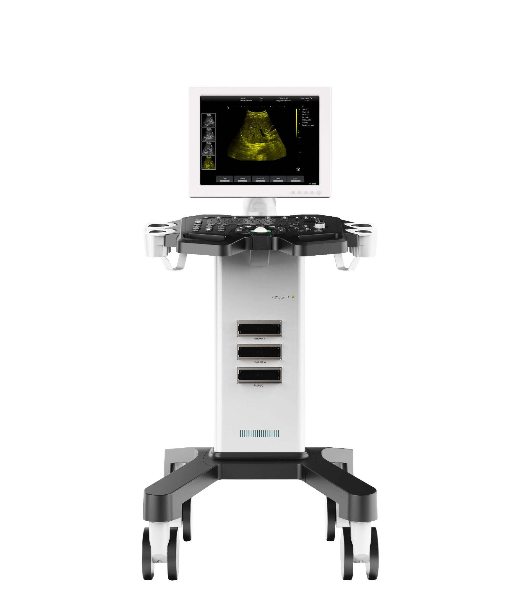 Usg Abdomen Sonography YJ-370T