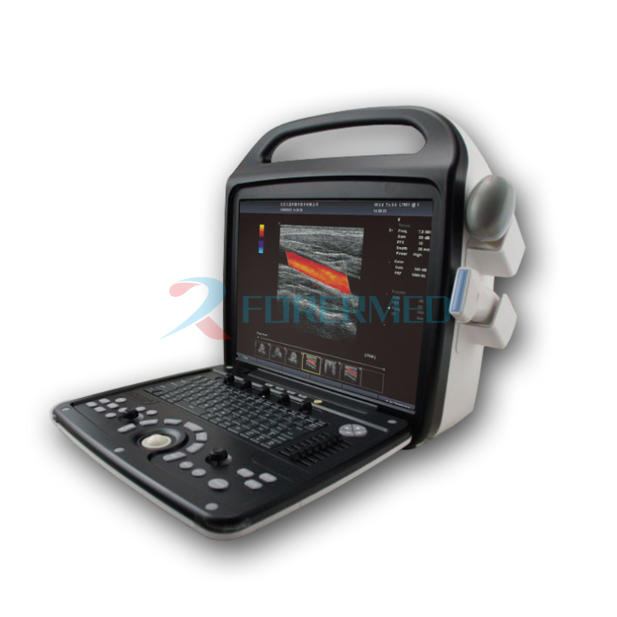 Pregnancy Ultrasound YJ-PR8