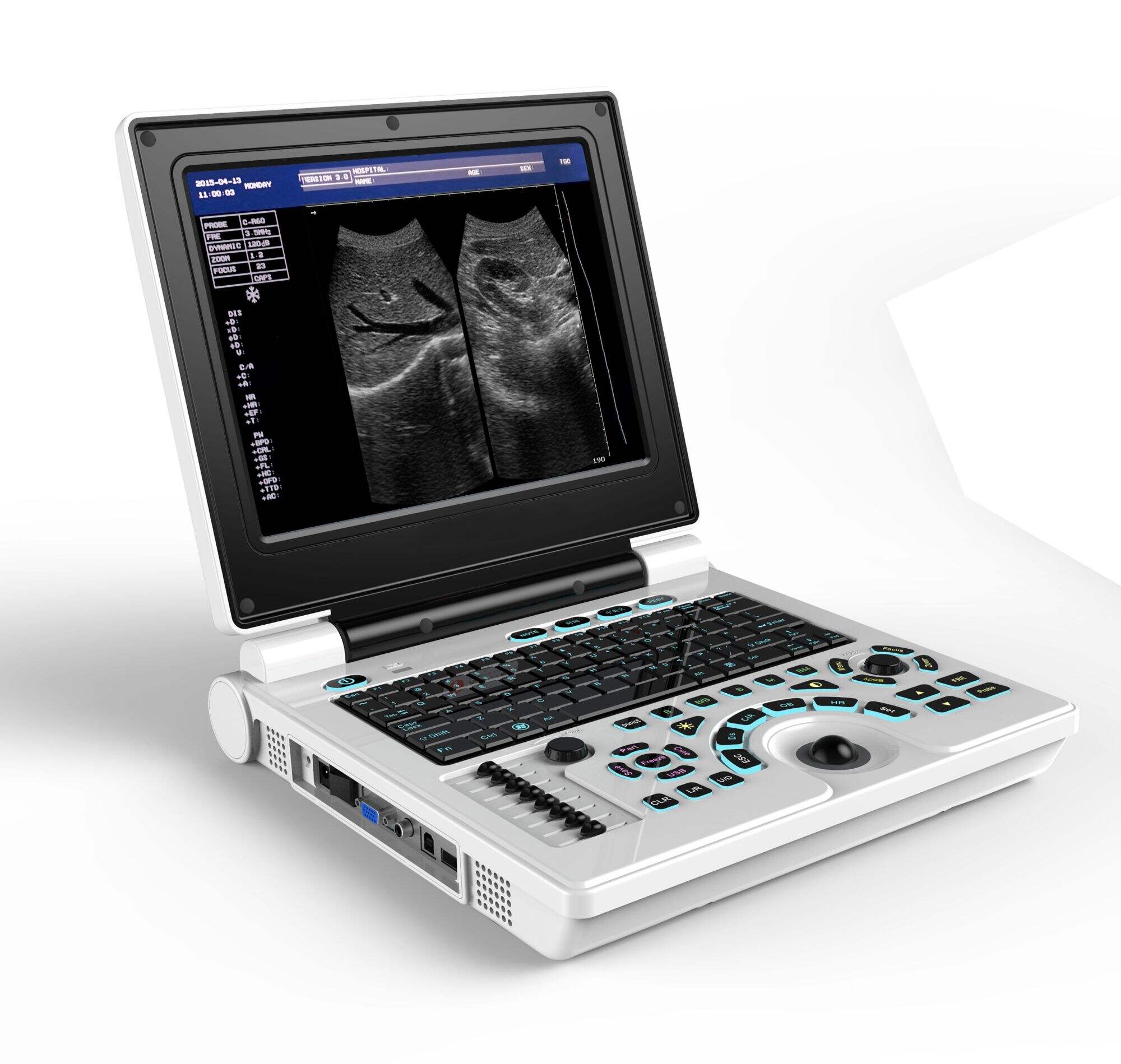 Black and White Ultrasound YJ-S30B