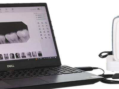 Latest Trends in Dental Digital X-Ray Sensors for Radiation Reduction