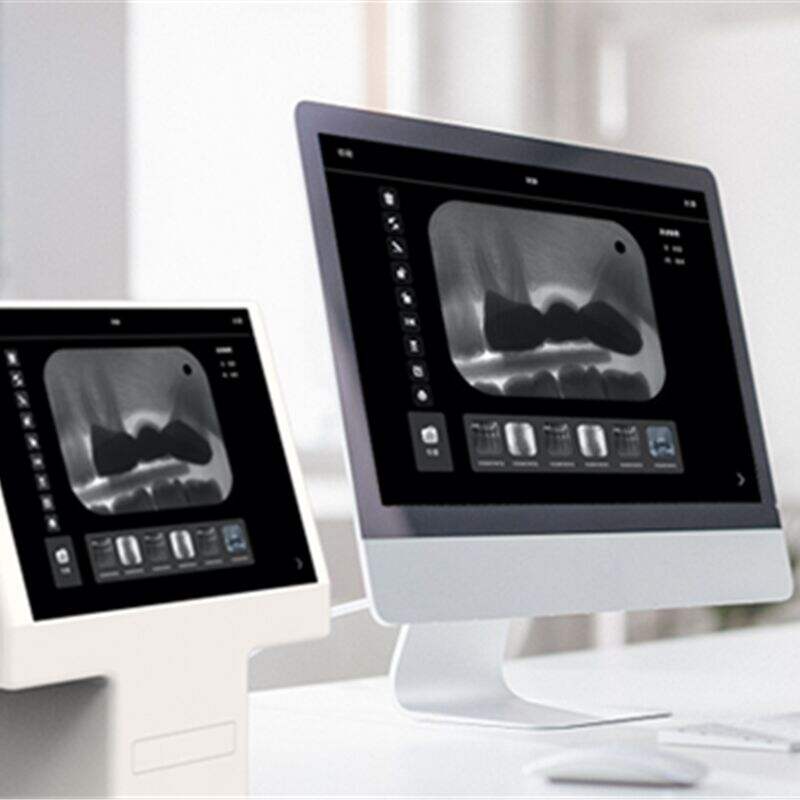 Dental X Ray Digital Sensors vs Film: Cost-Saving Benefits