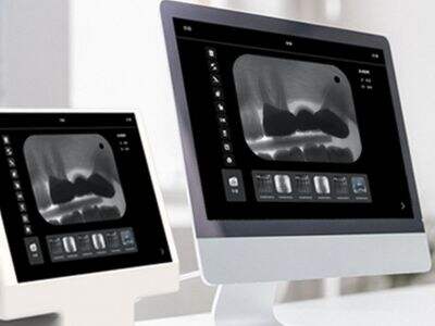 What Makes a High-Performance Dental Intraoral Scanner?