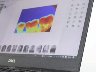 Cómo una cámara de radiografía dental simplifica la documentación de casos