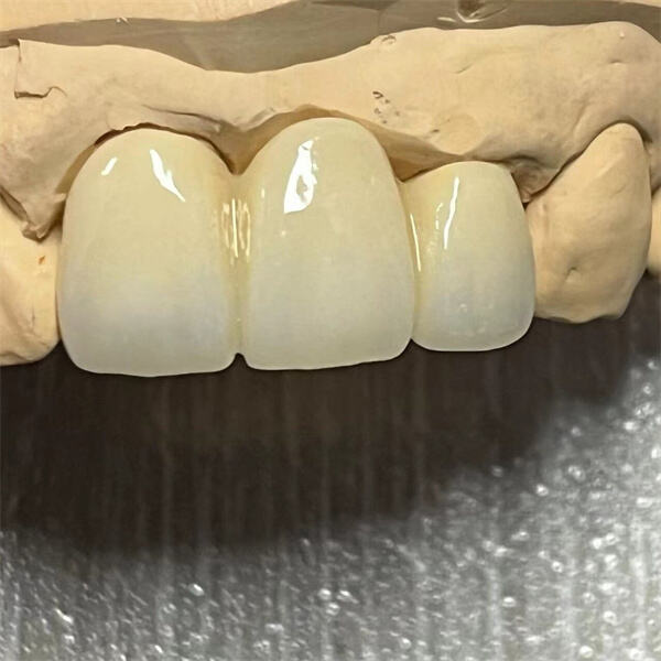 يتوفر تشكيل واسع من الأحجام والأشكال لجميع التطبيقات السنية