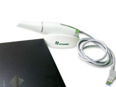 השוואת דיוק של סורקי פה אינטראאורליים: מה באמת חשוב