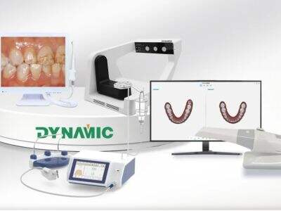 7 coisas a considerar ao comprar um scanner intraoral