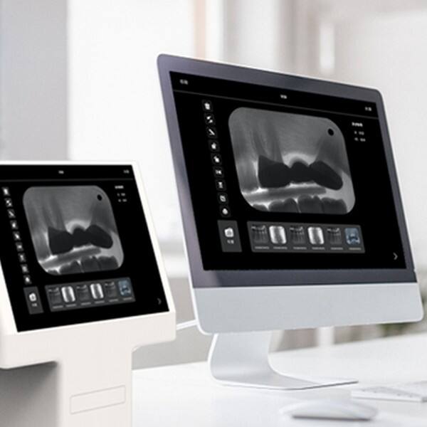 استمتع بجودة صور وتشغيل فائقة مع جهاز المسح الضوئي للوحات الفوسفور الموثوق لدينا