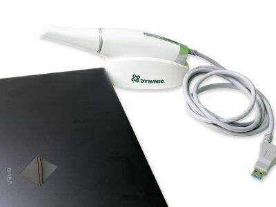 Jak cyfrowe skanery dentystyczne poprawiają dokładność wycisków stomatologicznych