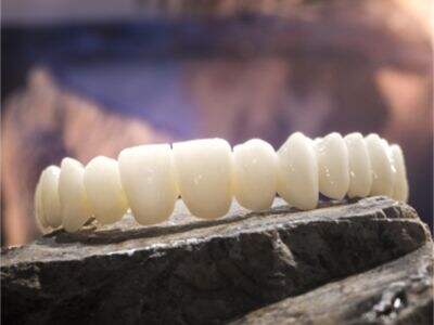 چگونه دستگاه فرز زیرکونیا مناسب آزمایشگاه دندانپزشکی خود را انتخاب کنید