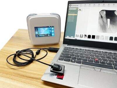 High-Resolution Dental X Ray Digital Sensors for Diagnosis