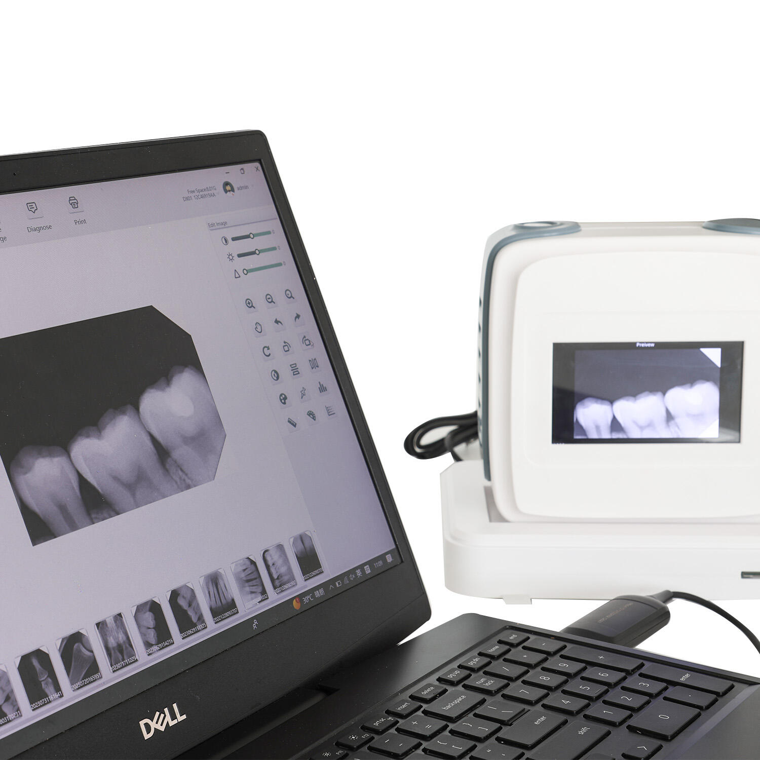 Principaux avantages de l'utilisation d'un appareil radiographique portable dans le diagnostic médical