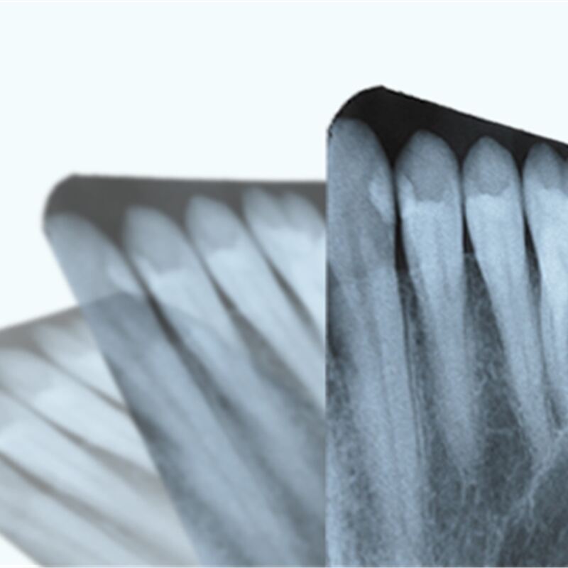 Popraw opiekę nad pacjentami dzięki zaawansowanym możliwościom rentgena