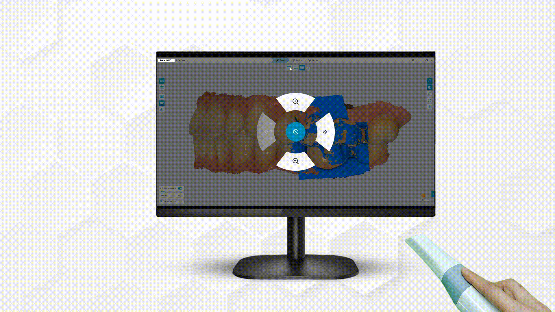 Dynamic DDS500 Dental Intraoral Scanner China Dynamic DDS500 Dental 