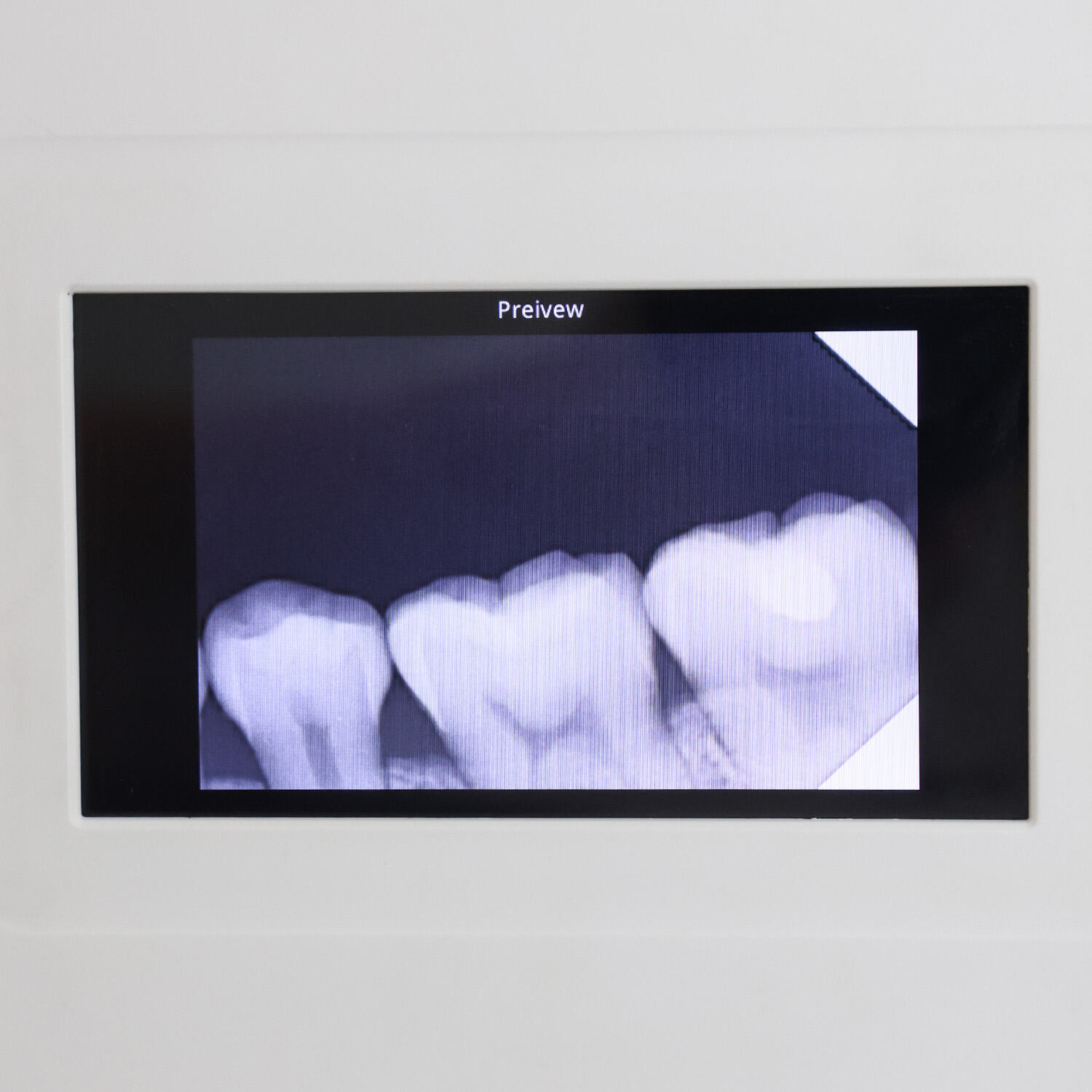 Typowe problemy z czujnikami stomatologicznymi i sposób ich rozwiązywania