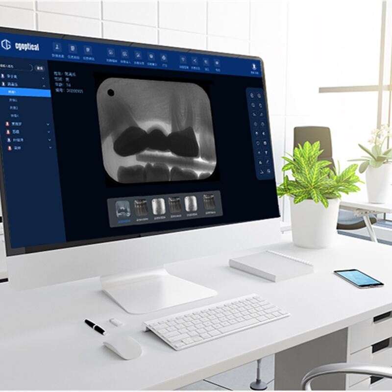 Ulepsz diagnozowanie i planowanie leczenia za pomocą najnowszych czujników stomatologicznych do sprzedania