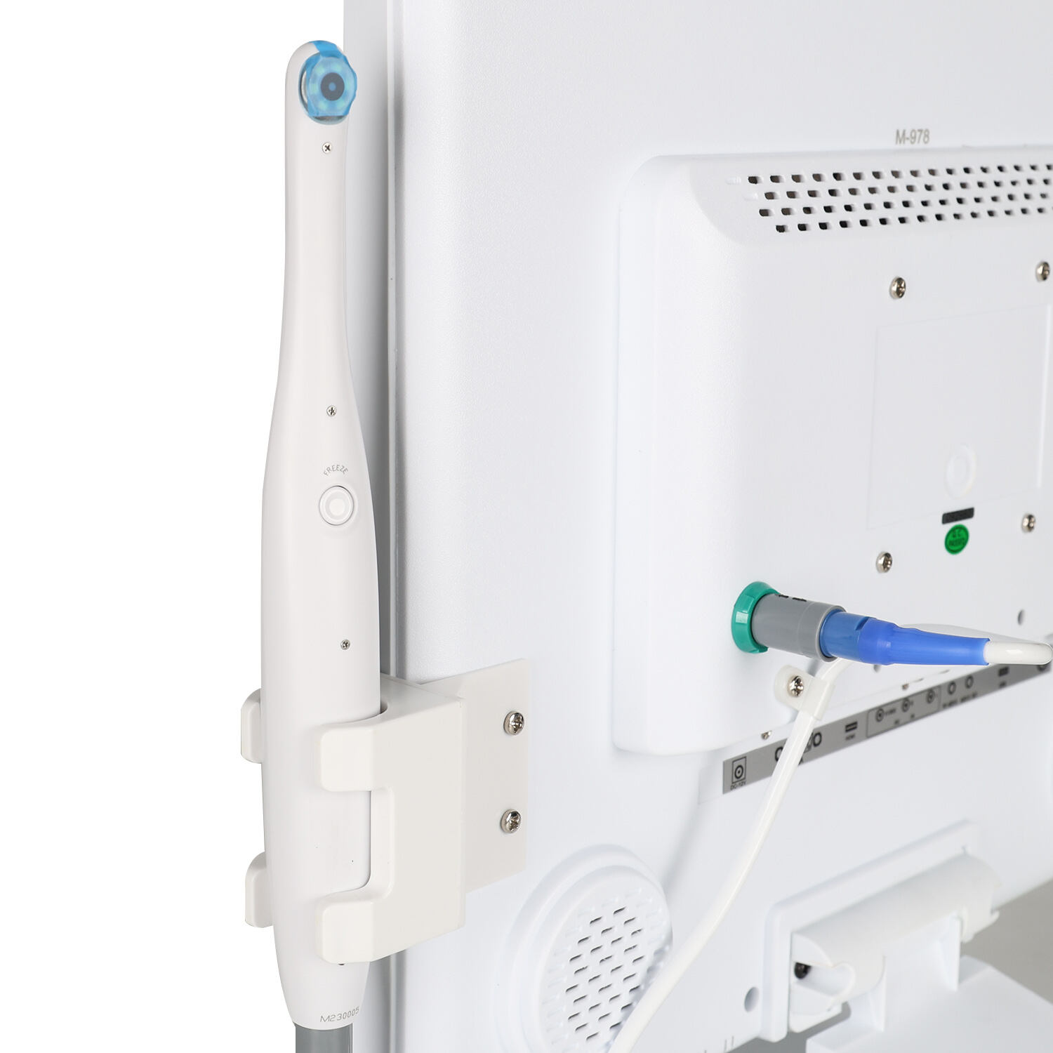 Przyszłość skanerów w stomatologii