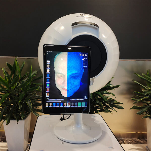 Discover Your Skin's True Health with AI Skin Analysis