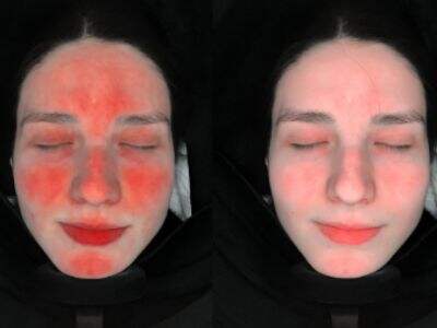 Analyzing Skin Detectors: Knowing Their Functions and Advantages