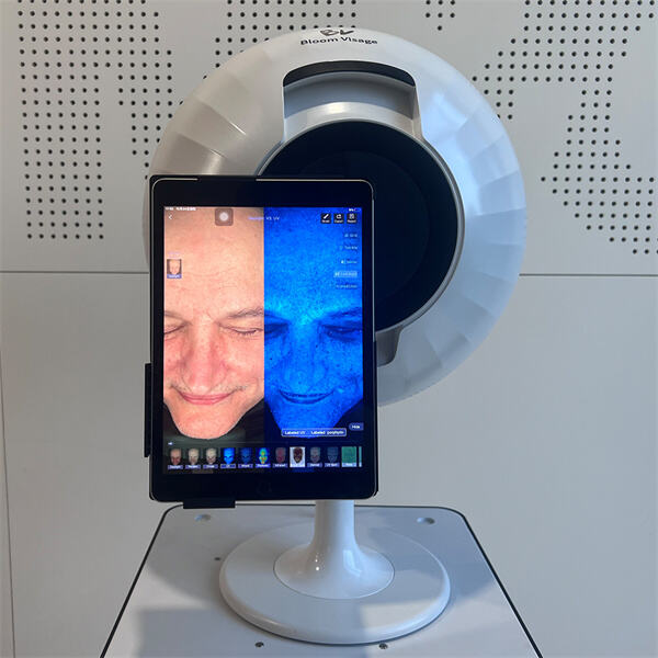 Како машина за анализу коже побољшава режиме лепоте