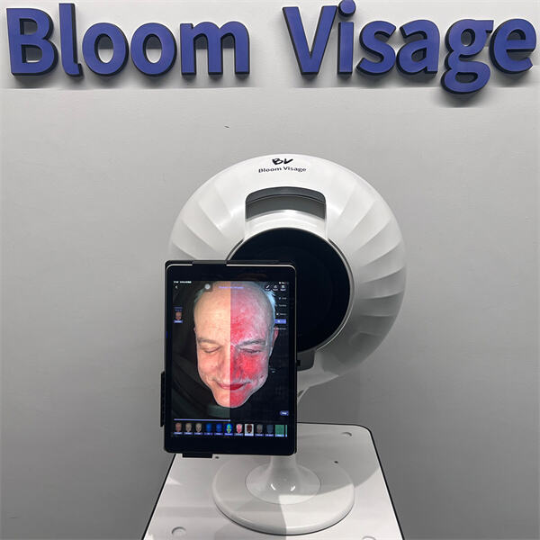 Процес у пет корака за успешну процену коже