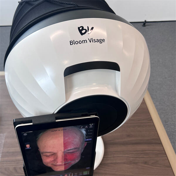 Револуционишите своју рутину за негу коже са прецизним резултатима наше машине за тестирање типа коже.