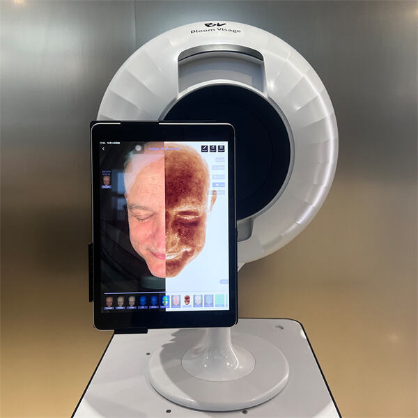 Analyser din hud fra hvor som helst