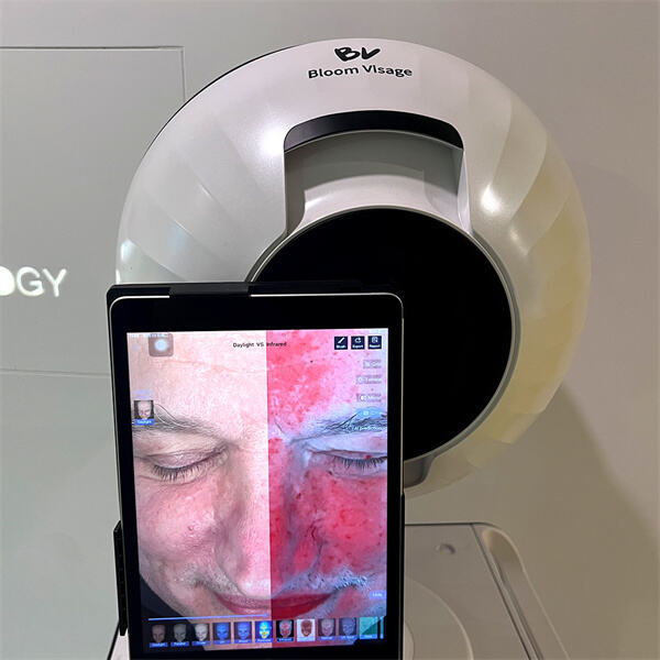 Шта ваш извештај открива о И