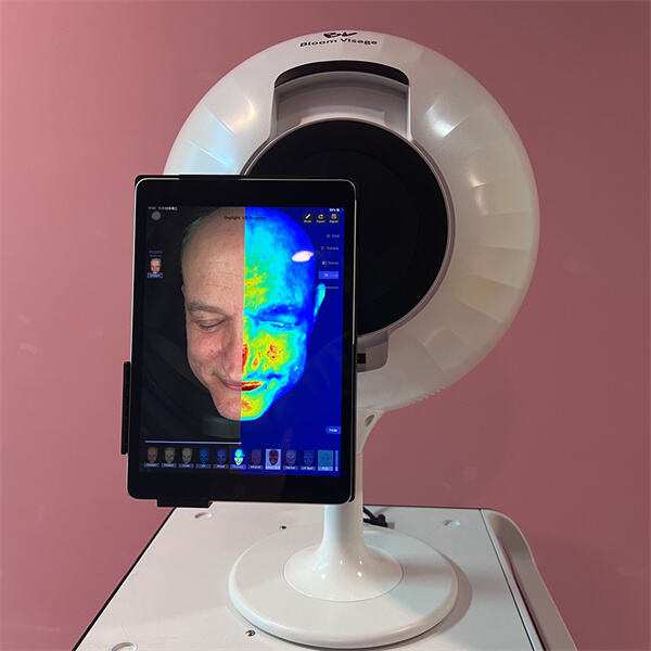 Користите уређај за дијагностику коже за беспрекорно кожу