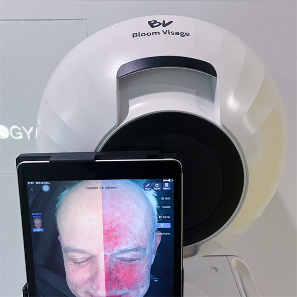 Детальніше: аналіз шкіри для процедур обличчя