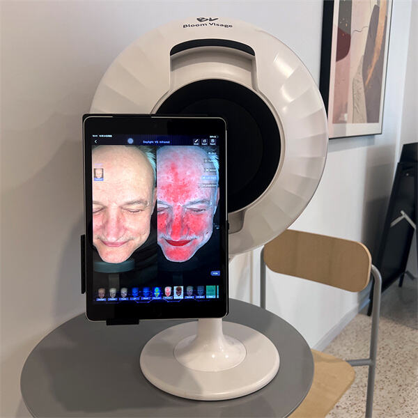Soluciones Personalizadas de Cuidado de la Piel a Través del Mapeo Facial de Análisis de Piel