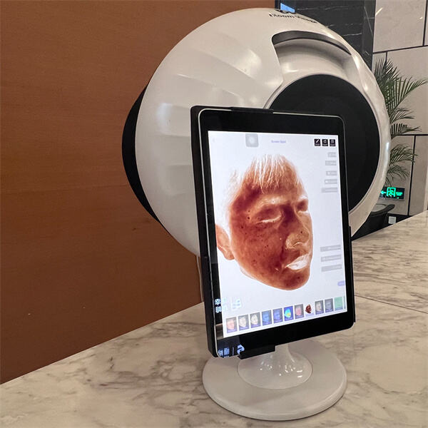 Преобразите своју рутину бриге о кожи са прецизном технологијом ИИ анализе коже