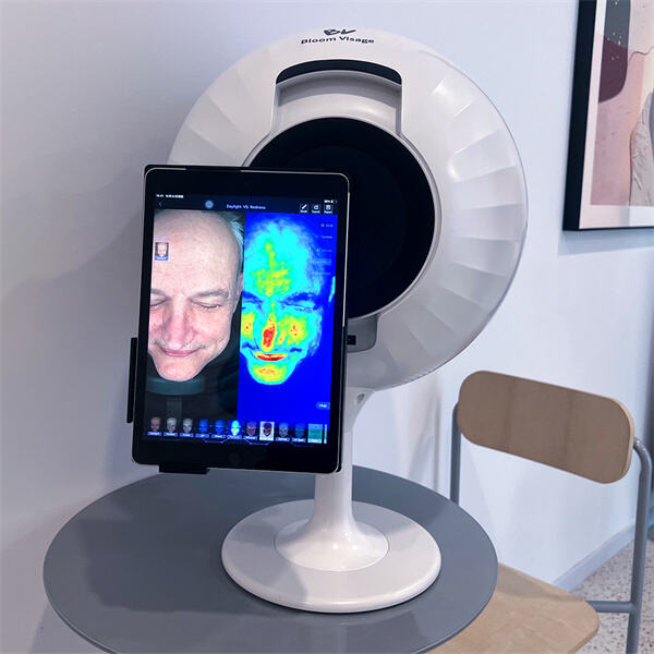 La importancia del mapeo facial para identificar preocupaciones de la piel