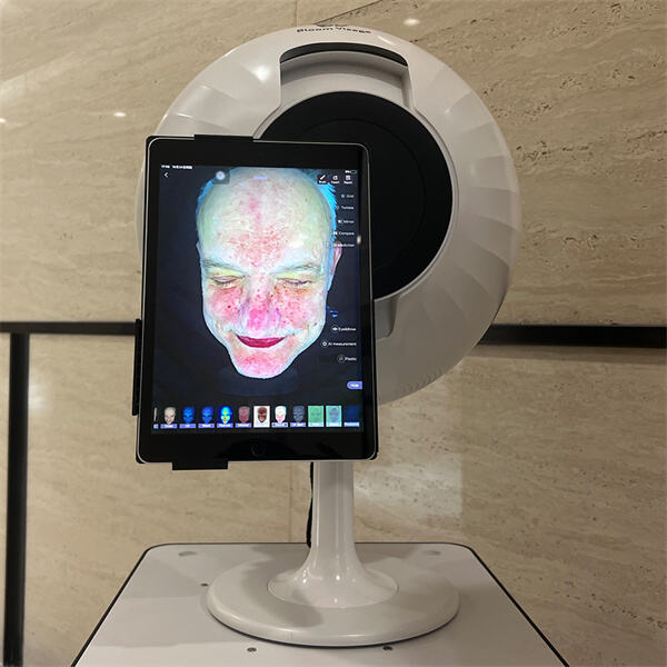 Знаци, симптоми и решења