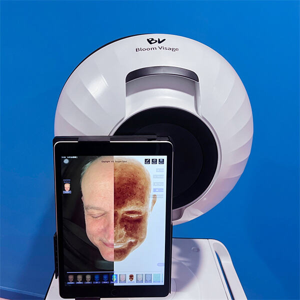 Відкривання справжнього стану вашої шкіри з точністю