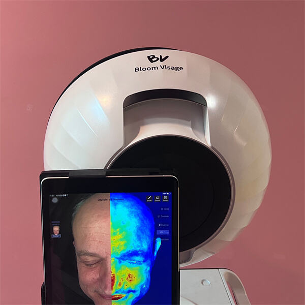 Добијте персонализован план за негу коже са уређајем за дијагнозу коже