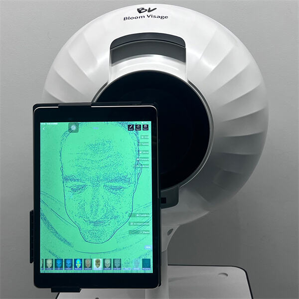 Контролишите здравље коже помоћу онлине анализатора коже