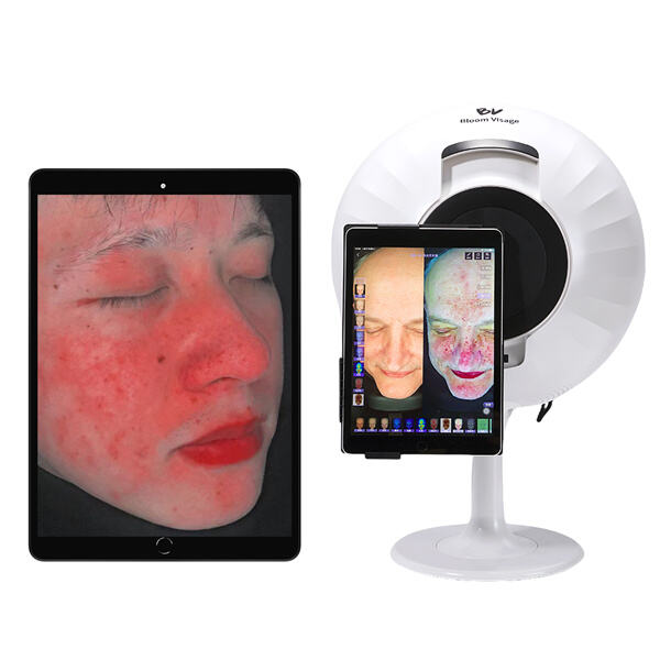 Откривање скривених проблема алатима за анализу Дермалогике